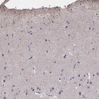 Anti-CACNG8 antibody produced in rabbit 