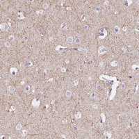 Anti-CADM4 antibody produced in rabbit 