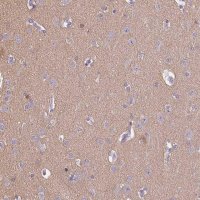 Anti-CADPS antibody produced in rabbit 