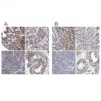 Anti-CALCOCO2 antibody produced in rabbit 