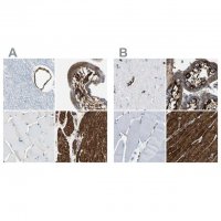 Anti-CALD1 antibody produced in rabbit 