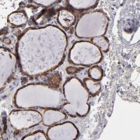 Anti-CALR antibody produced in rabbit HPA002242-100UL