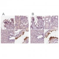 Anti-CALR3 antibody produced in rabbit 
