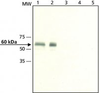 Anti-Calsequestrin-1 antibody produced in rabbit C0618-200UL