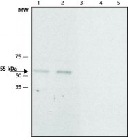 Anti-Calsequestrin-2 antibody produced in rabbit 