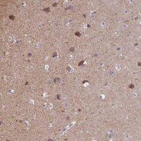 Anti-CAMKV antibody produced in rabbit 