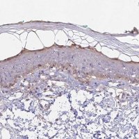 Anti-CAMSAP3 antibody produced in rabbit 