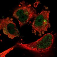 Anti-CAND1 antibody produced in rabbit HPA055748-100UL