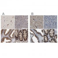 Anti-CANT1 antibody produced in rabbit 