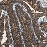 Anti-CAPN1 antibody produced in rabbit 
