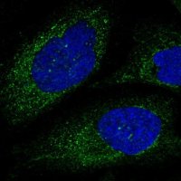 Anti-CAPN6 antibody produced in rabbit 