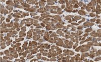 Anti-Cardiac Troponin I Antibody, clone 1F23, ZooMAb Rabbit Monoclonal 
