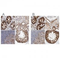 Anti-CARMIL1 antibody produced in rabbit 