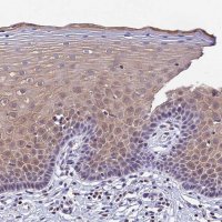 Anti-CARS2 antibody produced in rabbit 