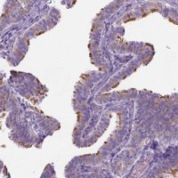 Anti-CASC1 antibody produced in rabbit 