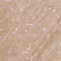 Anti-CASKIN1 antibody produced in rabbit 