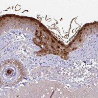 Anti-CASP14 antibody produced in rabbit 