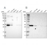Anti-CASP6 antibody produced in rabbit 