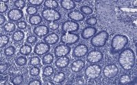 Anti-Caspase-8 Antibody, clone 1L15 ZooMAb Rabbit Monoclonal 