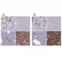 Anti-CASR antibody produced in rabbit 