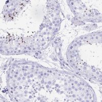 Anti-CATSPER4 antibody produced in rabbit 
