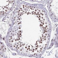 Anti-CBFA2T2 antibody produced in rabbit HPA060523-100UL