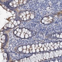 Anti-CBFB antibody produced in rabbit 
