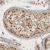 Anti-CBLL1 antibody produced in rabbit 