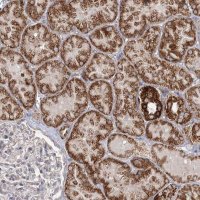 Anti-CBR4 antibody produced in rabbit 