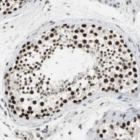 Anti-CBX3 antibody produced in rabbit 