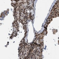 Anti-CBX5 antibody produced in rabbit 