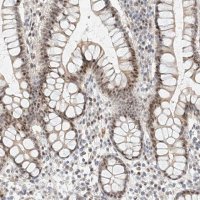 Anti-CBX8 antibody produced in rabbit HPA031462-100UL