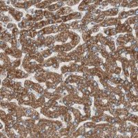 Anti-CC2D1A antibody produced in rabbit 