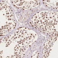 Anti-CCDC138 antibody produced in rabbit 