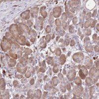 Anti-CCDC140 antibody produced in rabbit 
