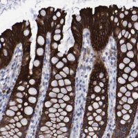 Anti-CCDC144NL antibody produced in rabbit 
