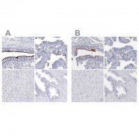 Anti-CCDC181 antibody produced in rabbit 