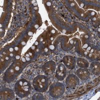 Anti-CCDC186 antibody produced in rabbit 