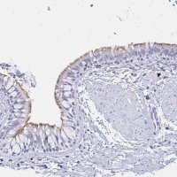 Anti-CCDC39 antibody produced in rabbit 