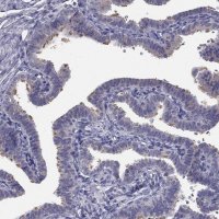 Anti-CCDC40 antibody produced in rabbit 