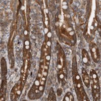 Anti-CCDC43 antibody produced in rabbit 