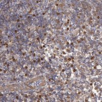 Anti-CCDC50 antibody produced in rabbit 
