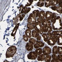 Anti-CCDC51 antibody produced in rabbit 