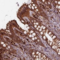 Anti-CCDC68 antibody produced in rabbit 