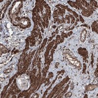 Anti-CCDC82 antibody produced in rabbit 