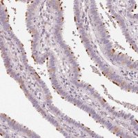 Anti-CCDC96 antibody produced in rabbit 