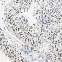 Anti-CCNT1 antibody produced in rabbit 