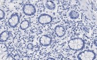 Anti-CCPG1 Antibody, clone 1F15 ZooMAb Rabbit Monoclonal 