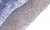 Anti-CCR2 Antibody, clone 5K5-3 ZooMAb Rabbit Monoclonal 