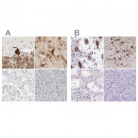 Anti-CCSAP antibody produced in rabbit 